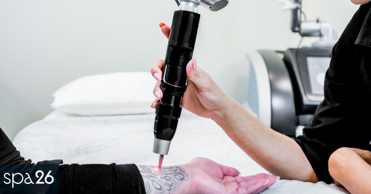 3 Types of Laser Tattoo Removal Devices