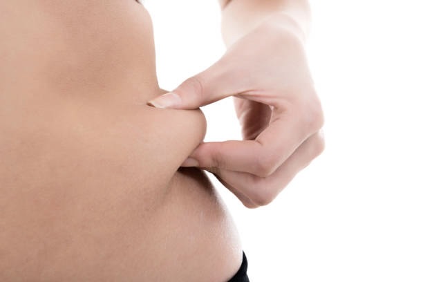 During AccuTite, FaceTite, and BodyTite