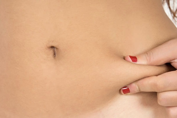 AccuTite, FaceTite, and BodyTite Treatment Areas