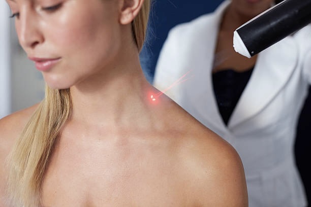 Am I a Good Candidate for Profractional Laser Resurfacing
