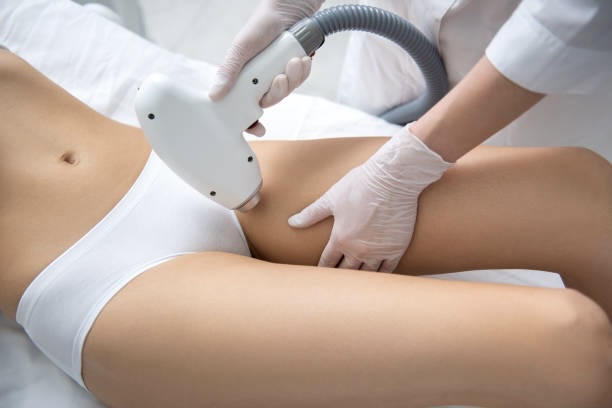 Brazilian Laser Hair Removal Treatment Areas