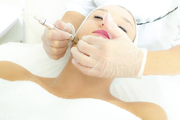 During Diamond Glow Microdermabrasion