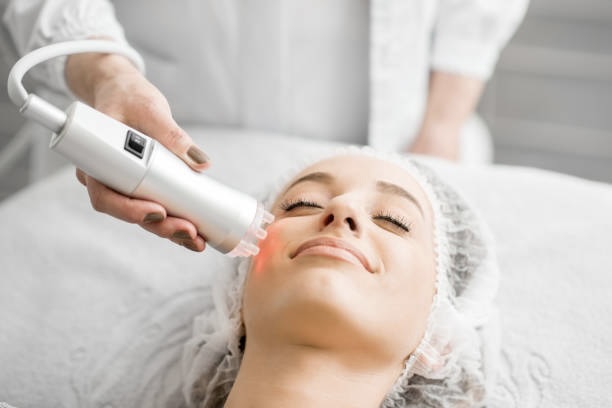 During HALO Fractionated Resurfacing