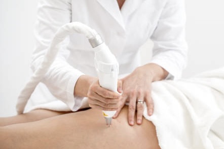 during laser vein removal