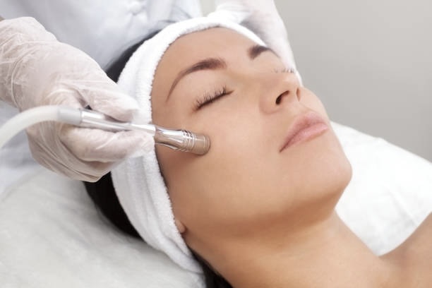 during pelleve skin tightening
