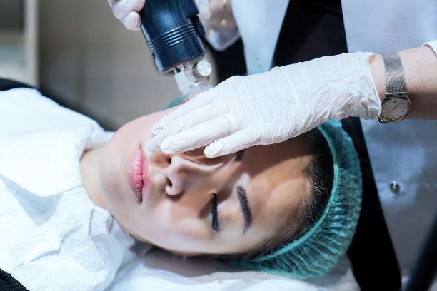 During PicoFocus Pigmentation Reduction