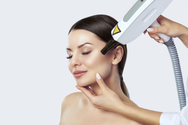Erbium Contour TRL Resurfacing Side Effects