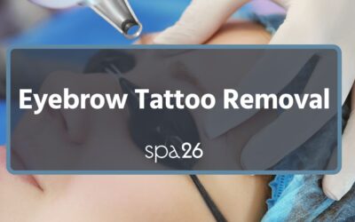 Eyebrow Tattoo Removal