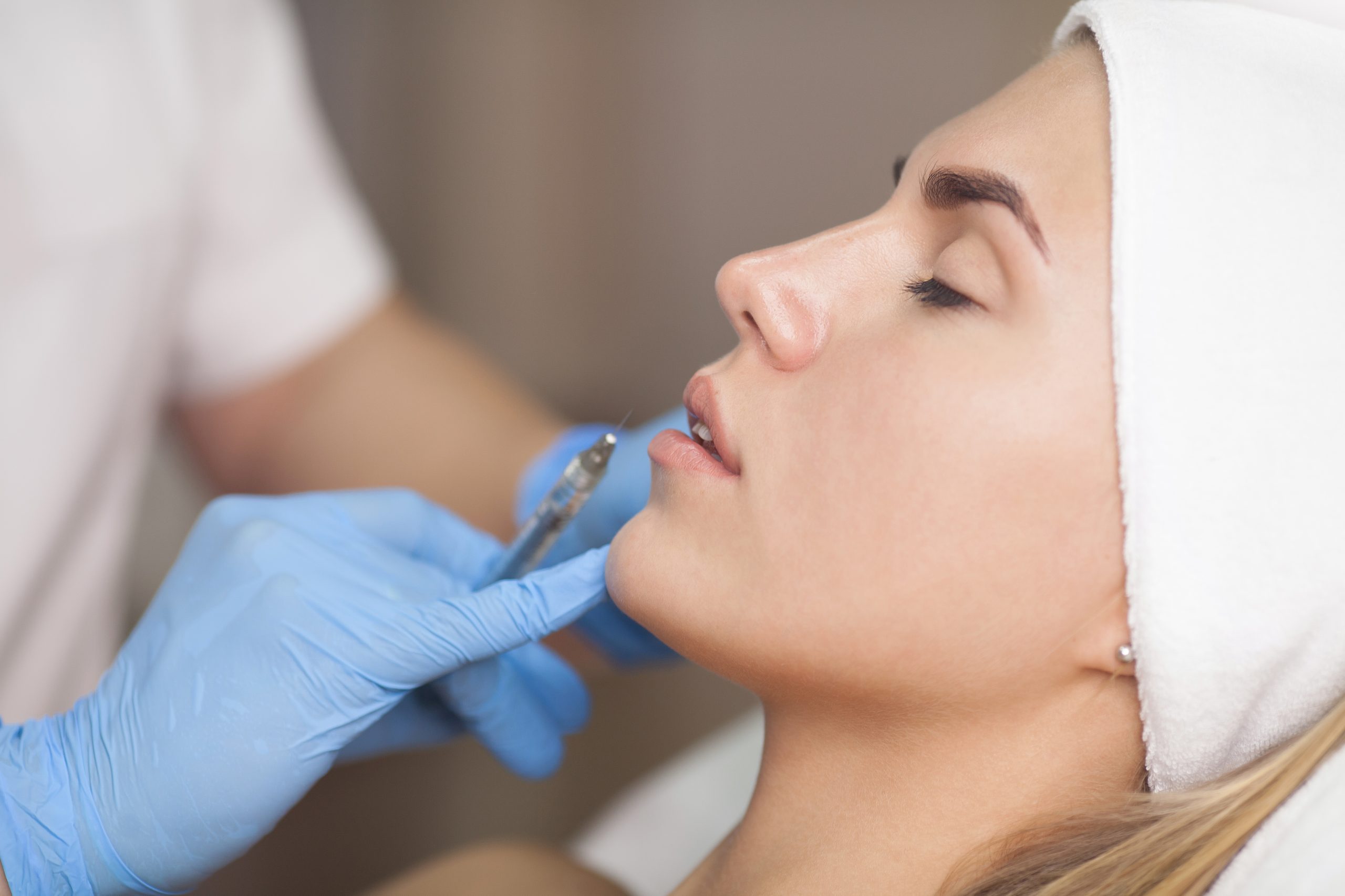 Beauty,Injections,Close,Up.,Lip,Filler,Injection. Filler Reversal Beverly Hills