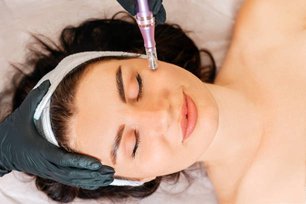 Gold Tip Facial Treatment Areas