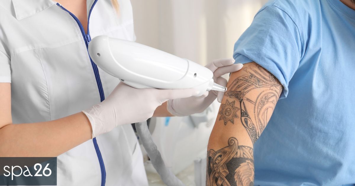 How Long Does Each Tattoo Removal Session Take?