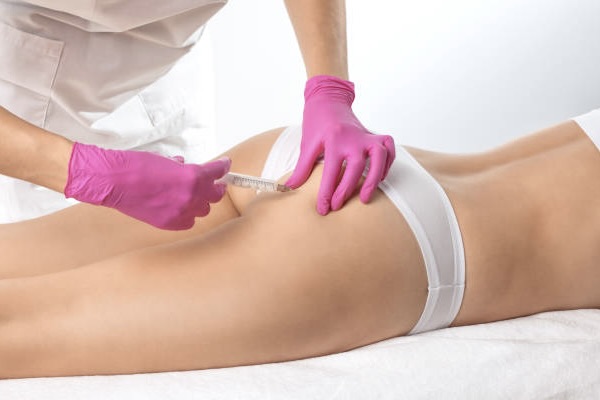 How Long QWO Cellulite Treatment Results