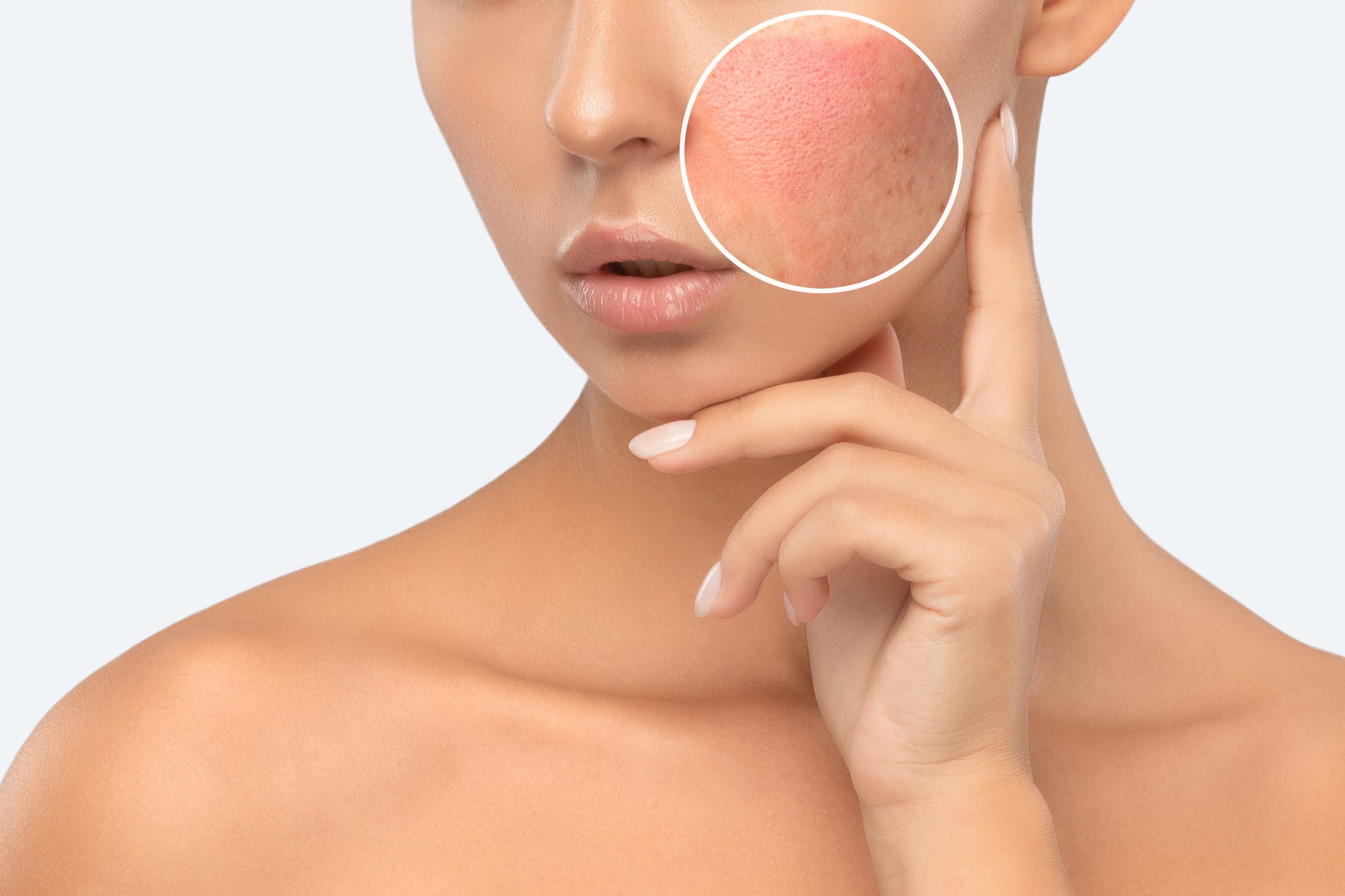 MicroLaser Peel For Resurfacing Beverly Hills Spa26 MicroLaser Peel For Resurfacing Beverly Hills Spa26