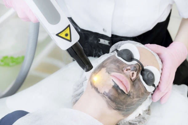 MicroLaser Peel Similar Related Procedures