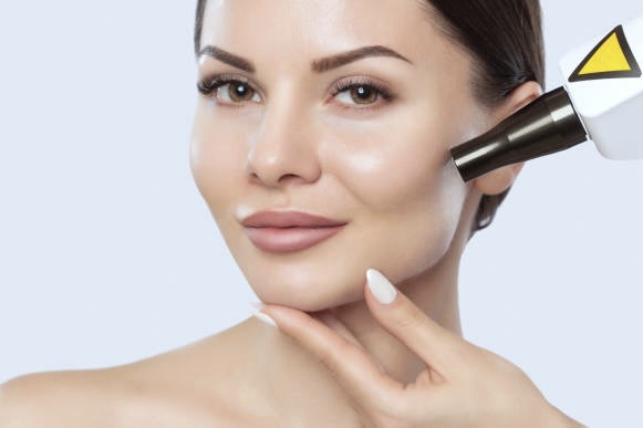 MicroLaser Peel Treatment Areas