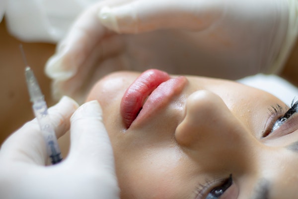 injecting dermal filler