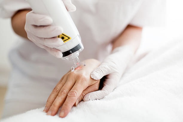 Profractional Laser Resurfacing Treatment Areas
