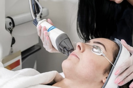Profractional Laser Resurfacing vs