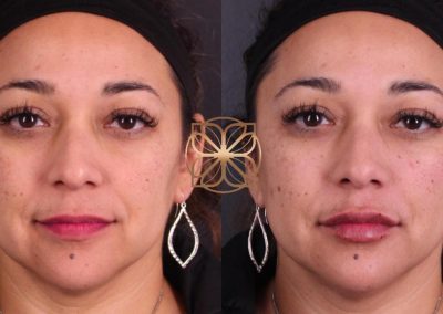 Spa26 B&A filler.pptx