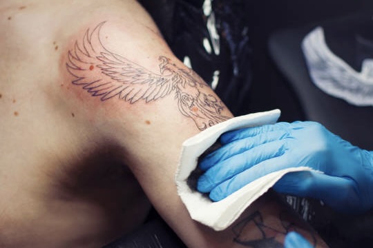 tattoo removal similar procedures