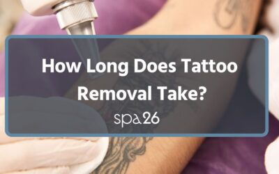 How Long Does Tattoo Removal Take?