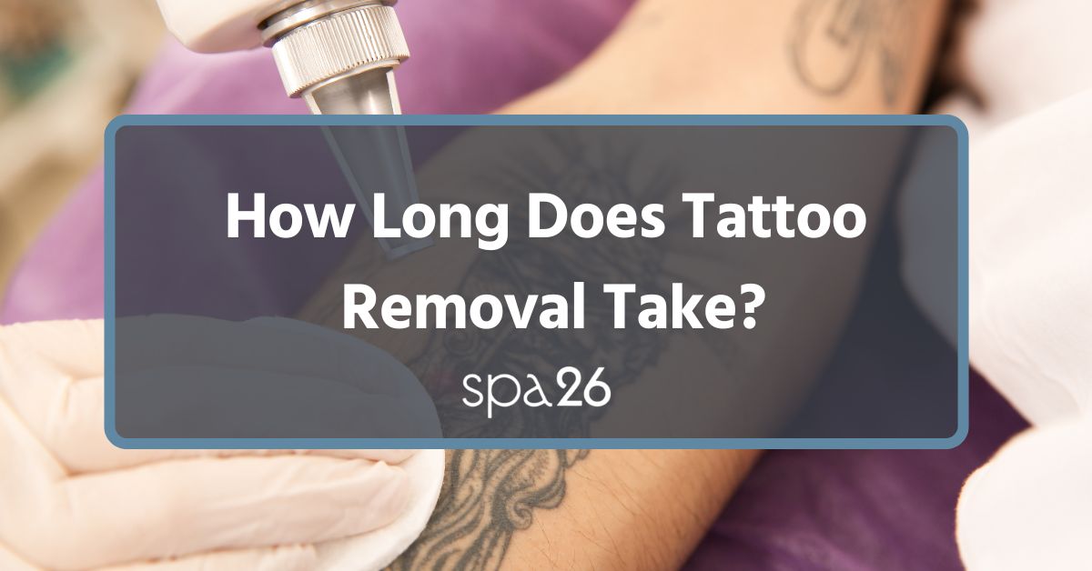 How Long Does Tattoo Removal Take?