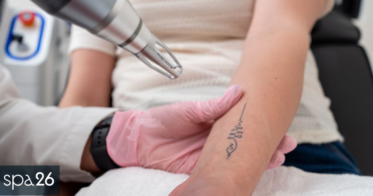 What to Look for When Choosing the Best Tattoo Removal Laser