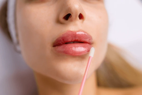 Close-up of lips with aftercare application following Juvederm Volbella XC procedure for lip enhancement and hydration