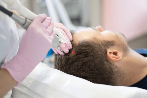 Patient undergoing aftercare procedure after NeoGraft hair transplant, ensuring proper healing and optimal results
