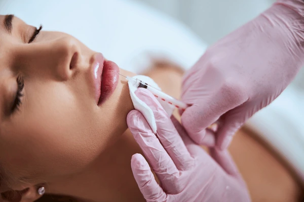 Close-up of Restylane Kysse lip filler injection providing natural volume, enhanced lip color, and long-lasting hydration