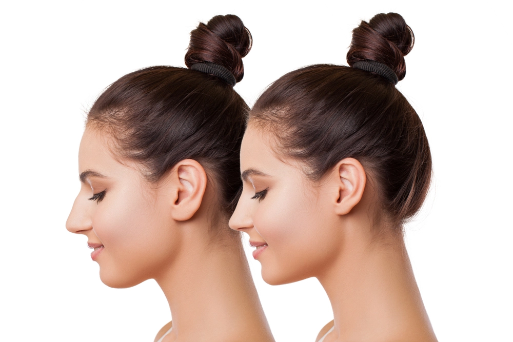 Body contouring treatment for fat reduction and skin tightening.