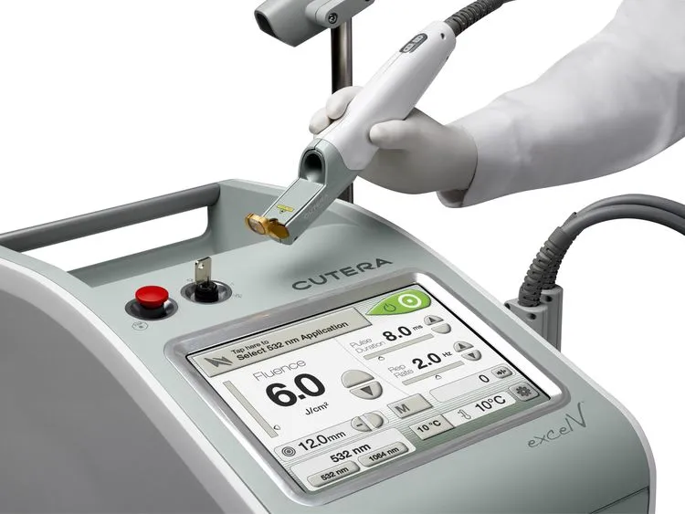 GenesisV Laser Treatment Beverly Hills