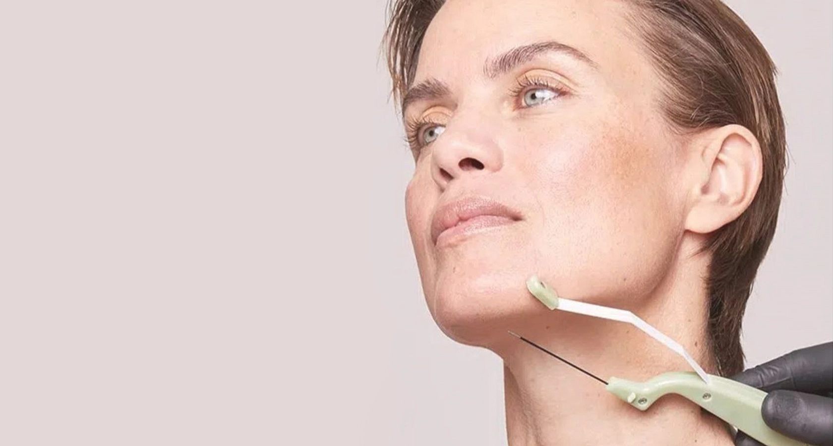 Medical professional performing a Facetite procedure with advanced device for facial contouring and skin tightening.