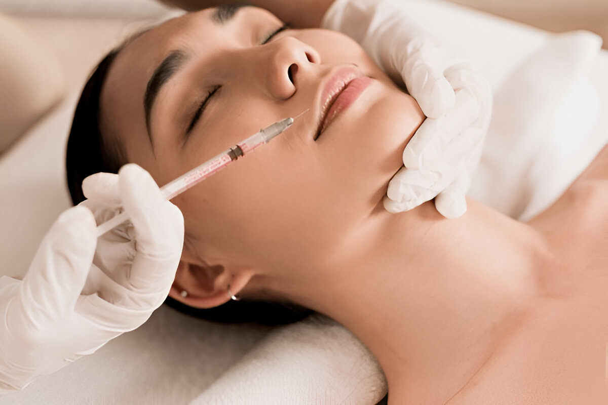 Close-up of Juvederm Ultra Plus XC injection during procedure for smooth skin and enhanced facial volume treatment