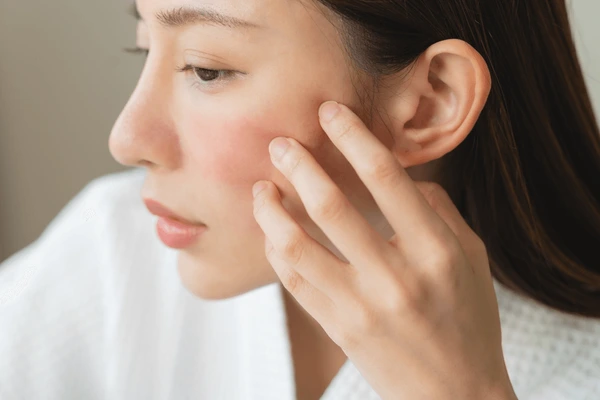 Asian woman checking skin for side effects of Juvederm Ultra Plus XC, such as redness, swelling, or tenderness post-treatment