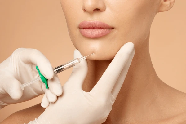 juvederm-ultra-xc-chin-filler-injection Juvederm Ultra XC injectable being used as a chin filler for contour enhancement