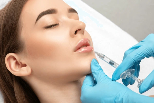 Lip augmentation with Juvederm Ultra XC injection showing similar procedures like dermal fillers for enhancing lip volume and smoothness
