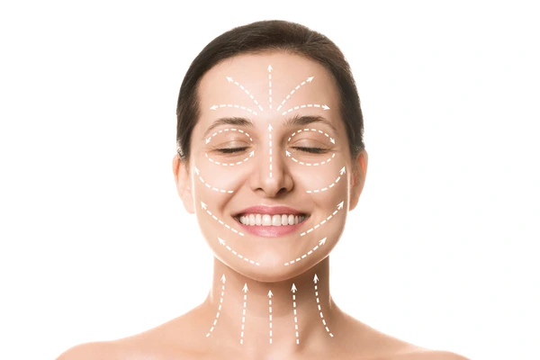 Marked treatment areas on the face for TempSure Envi RF procedure, highlighting skin tightening zones