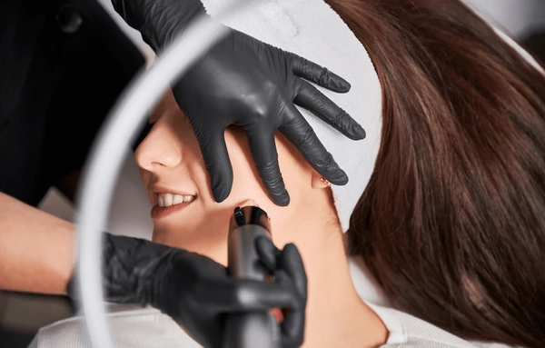TempSure Envi RF treatment during procedure for skin tightening and wrinkle reduction on the face