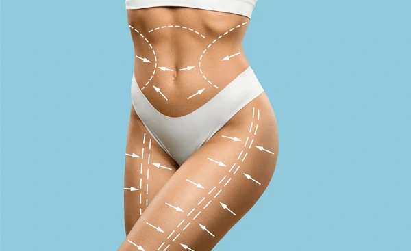 Targeted areas for TempSure Firm treatment showing body contouring and skin tightening for abdomen and thighs