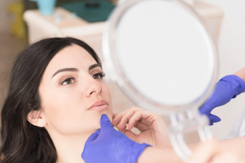 Potential side effects of Vivace RF microneedling treatment on the face, ensuring patient awareness and care