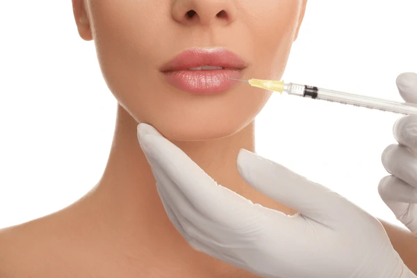 Restylane Silk procedure for lip augmentation, enhancing lip shape, volume, and achieving a natural, smooth look